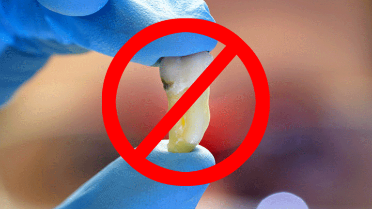 Удаление зуба в клинике Сатори Дент